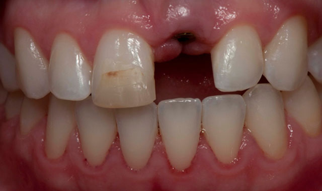 Smile Gallery Image