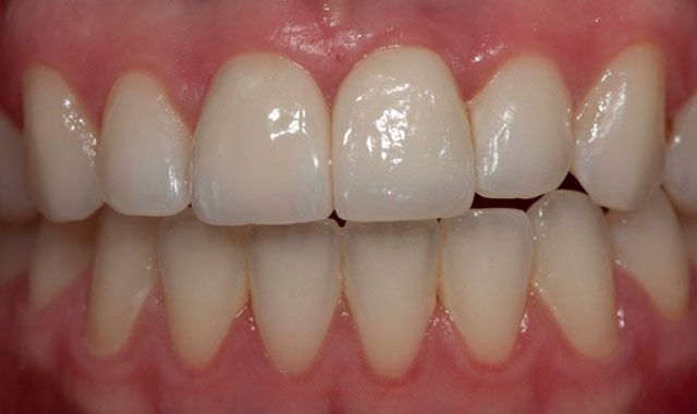Smile Gallery Image
