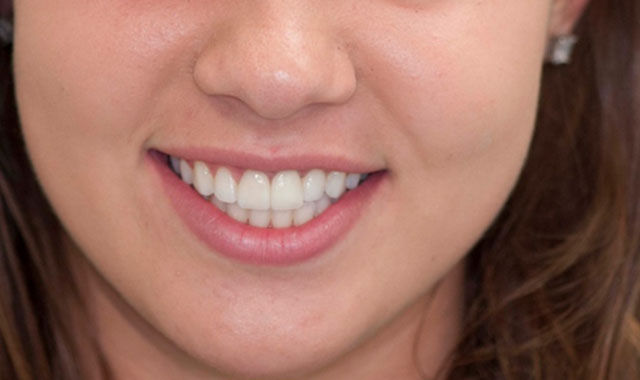 Smile Gallery Image