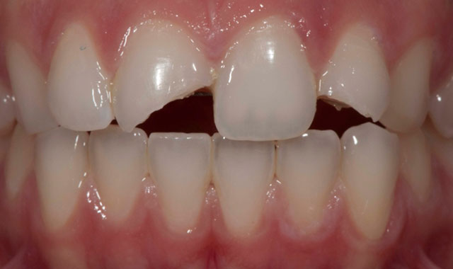 Smile Gallery Image