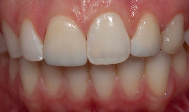 Smile Gallery Image