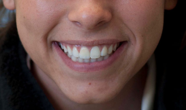 Smile Gallery Image