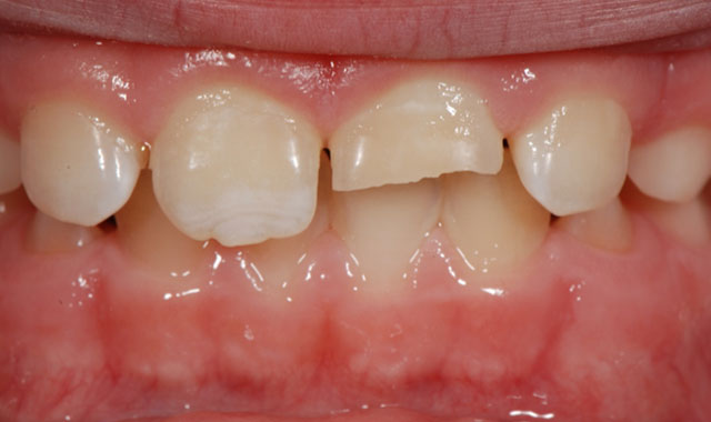 Smile Gallery Image