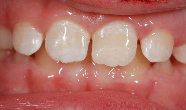 Smile Gallery Image