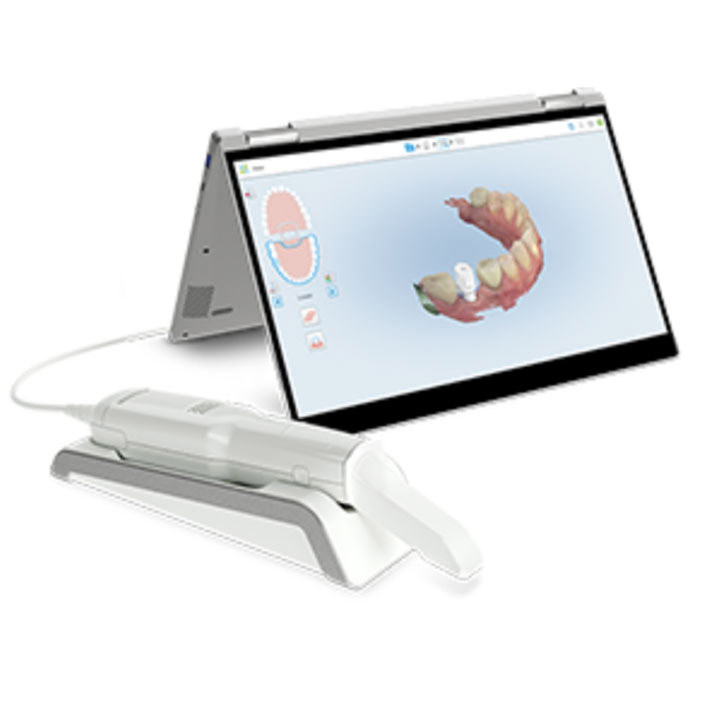 Intraoral Scanner in Crown Point, IN